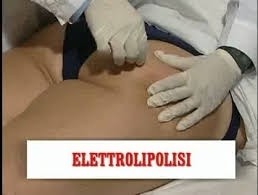 L' ELETTROSTIMOLAZIONE AD AGHI CHE RIDUCE I DEPOSITI DI GRASSO LOCALIZZATO - MEDI CLINIC LUXURY
