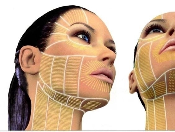 ENDOLIFTING  LASER - MEDI CLINIC LUXURY