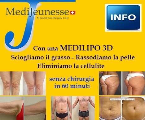MEDILIPO : LA LIPOSCULTURA LASER A FIBRA OTTICA - MEDI CLINIC LUXURY
