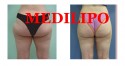 slideshow