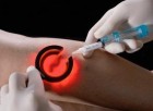 TERAPIA DELLE VARICI - Medi Jeunesse Lugano