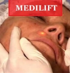 Medi Jeunesse Lugano